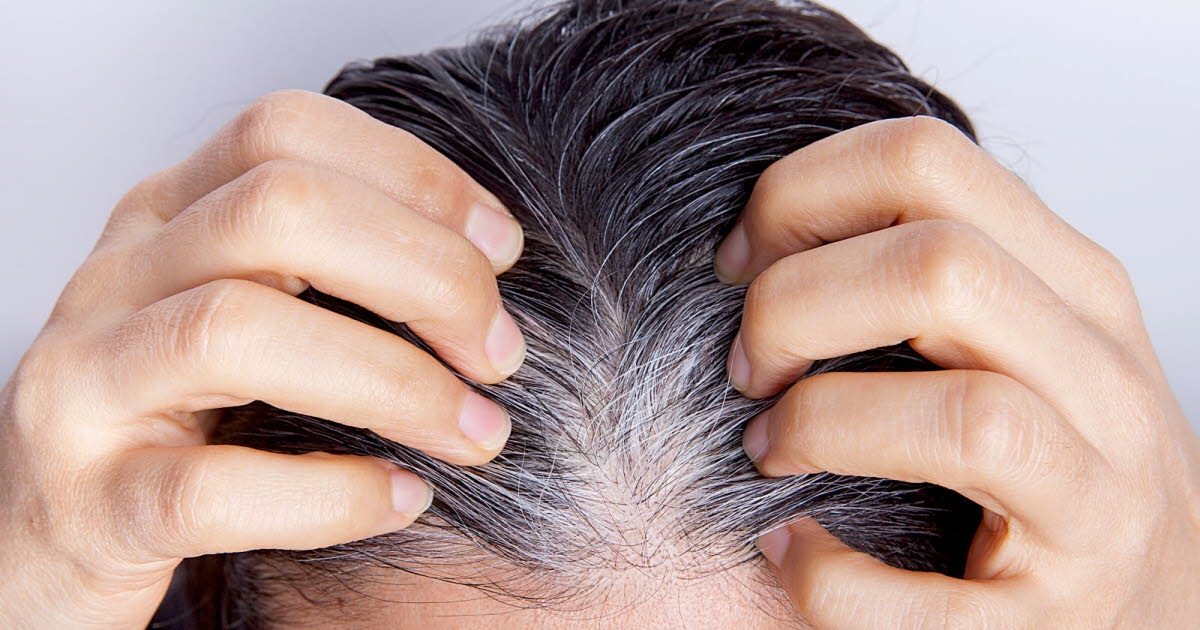 Health. Can hair suddenly turn white due to stress or illness?