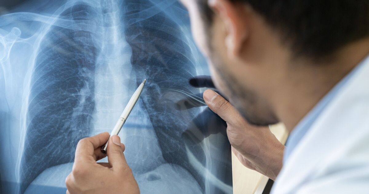 Un estudio revela que los microplásticos podrían estar causando estragos en los pulmones