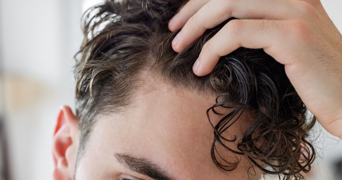 Doctor says Mounjaro’s hair loss side effect could be preventable