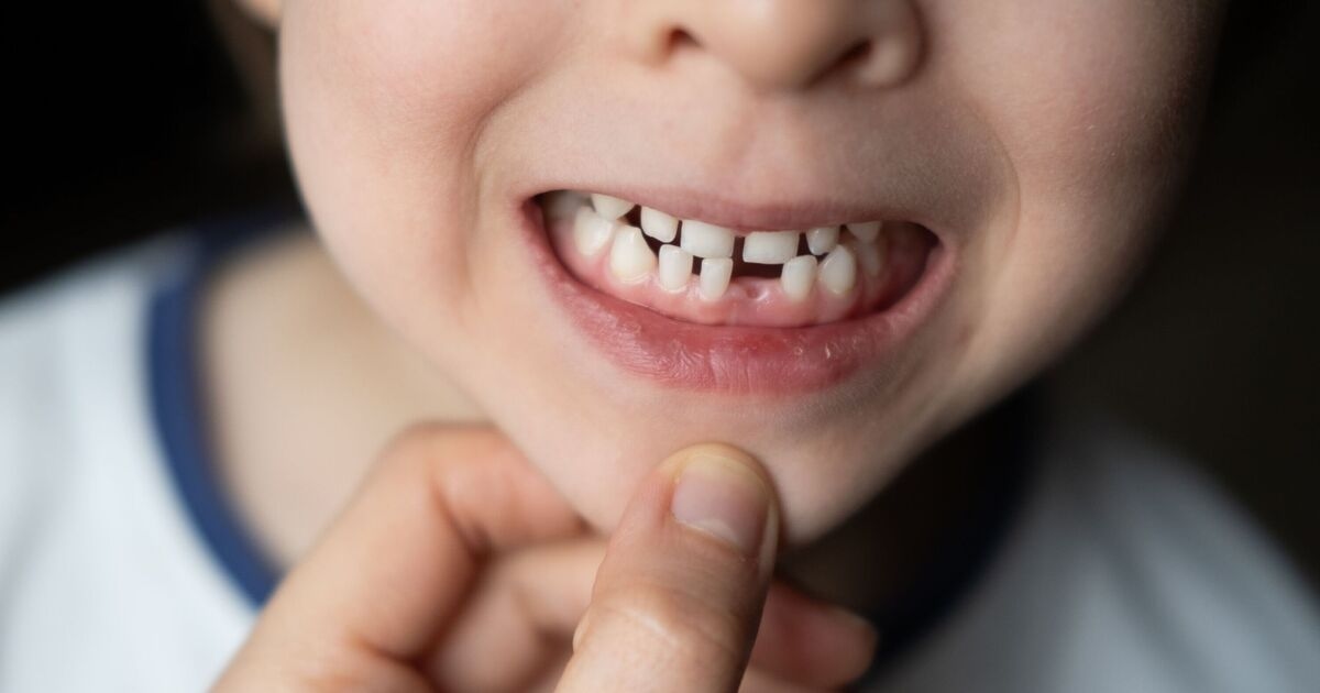 Ich bin Zahnarzt – diese Symptome bei Kindern niemals ignorieren