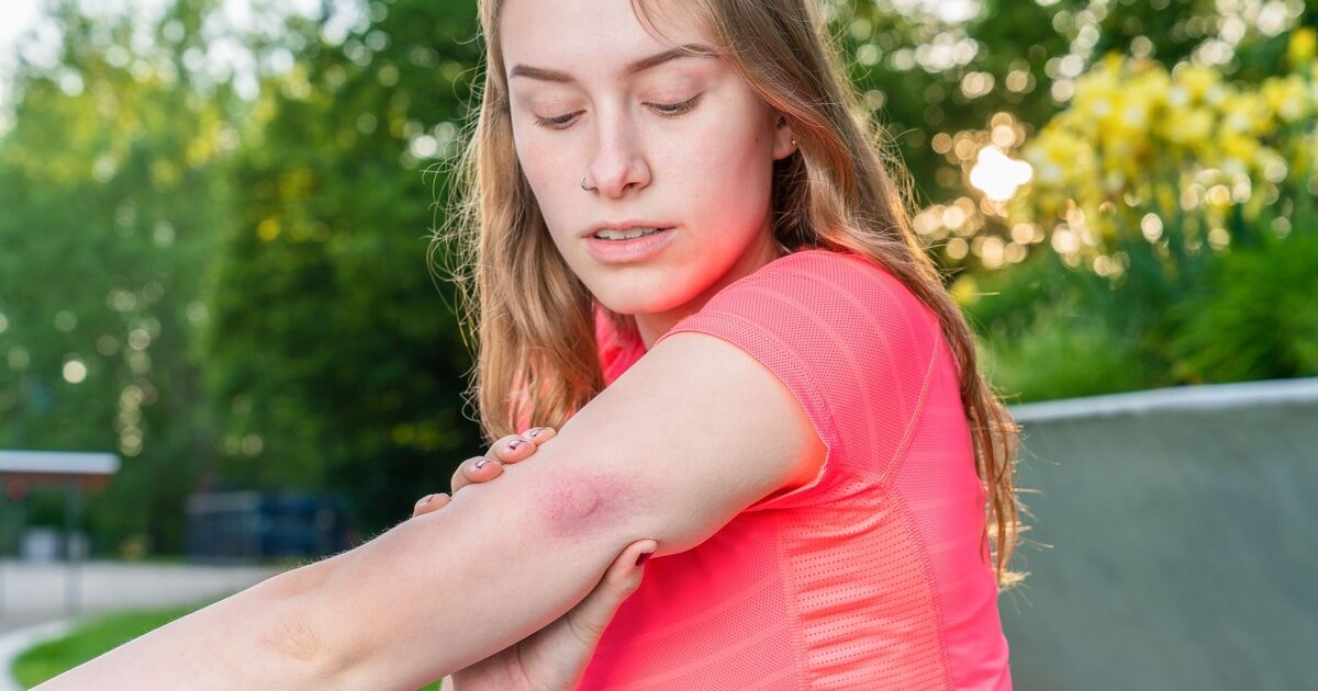 Don't get bitten again... 7 ways to stop insects without heavy-duty chemicals