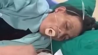 Des images horribles d'un ver solitaire géant retiré de la bouche d'une femme déclenchent l'avertissement urgent d'un médecin concernant une erreur de cuisson courante