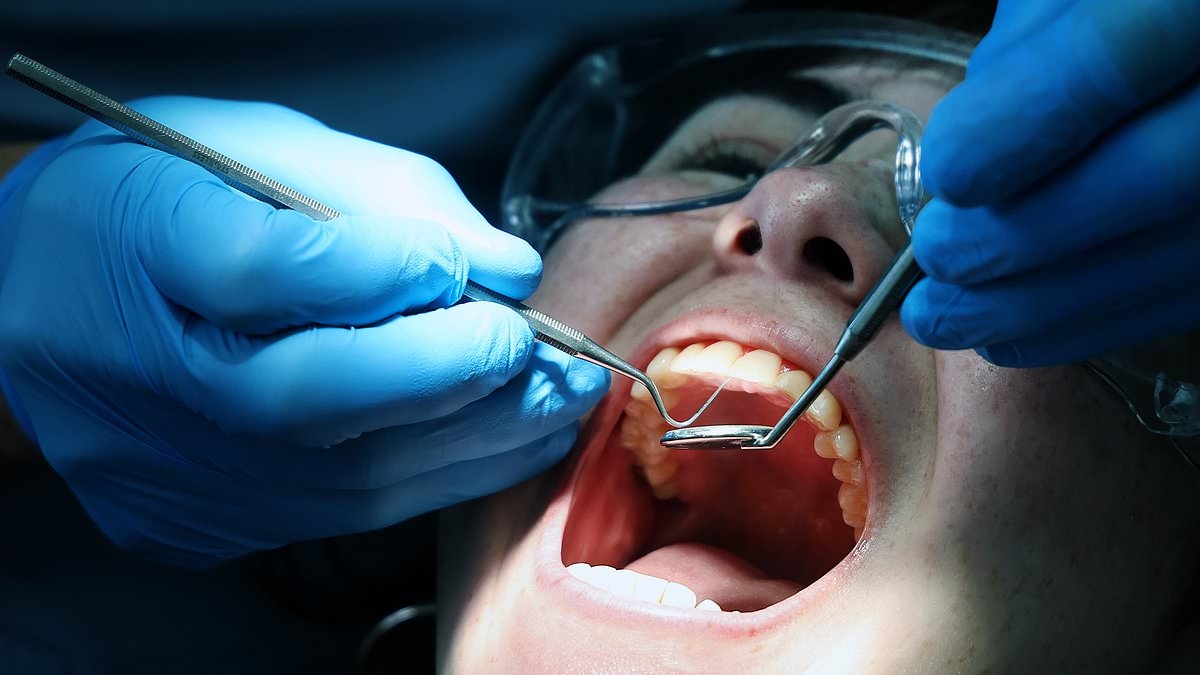 I leader medici avvertono che i britannici che necessitano di cure dentistiche urgenti potrebbero essere costretti a ricorrere alle soluzioni dell'"era Vittoria", poiché 2,2 milioni di persone sono in attesa di cure