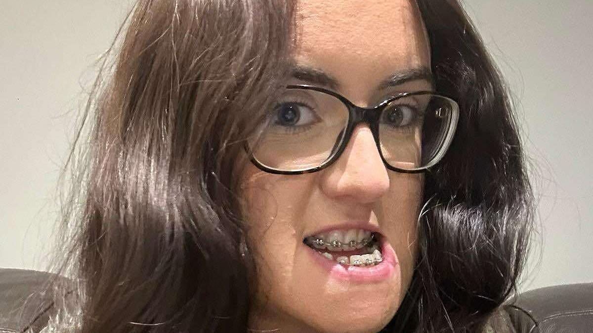 Woman, 26, reveals astonishing transformation after brutal five hour surgery to correct huge underbite: 'Pain was worth it'