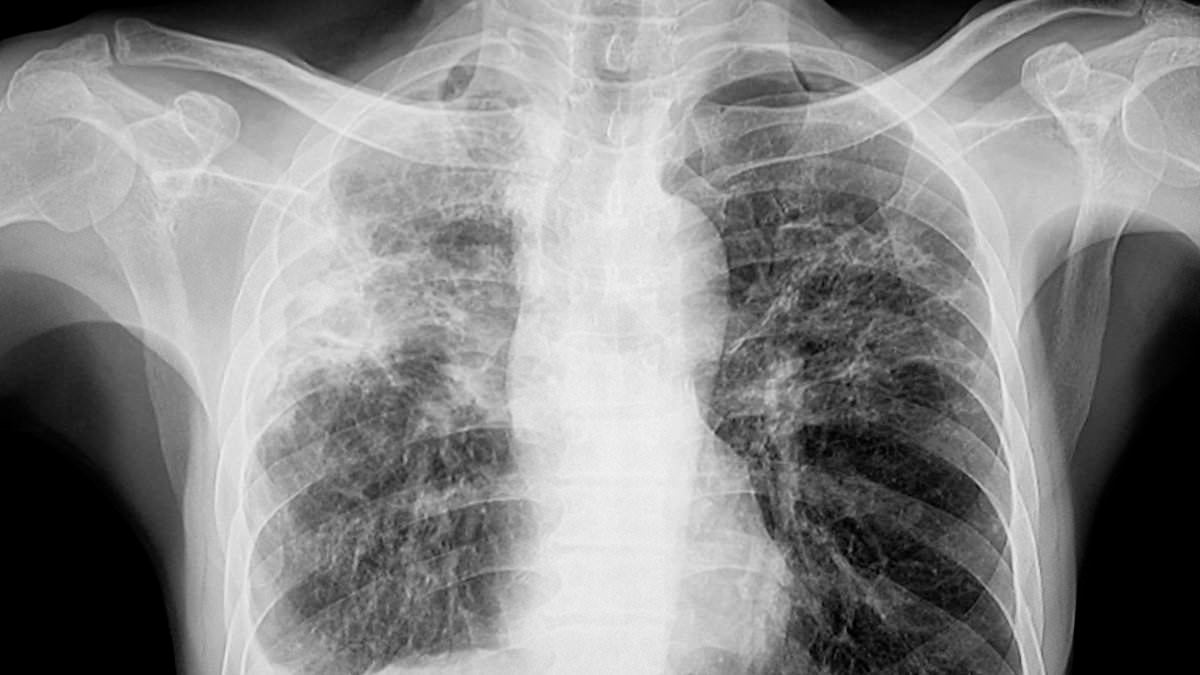 El pánico se extiende a medida que los residentes de Maine se infectan con la enfermedad más mortal del mundo