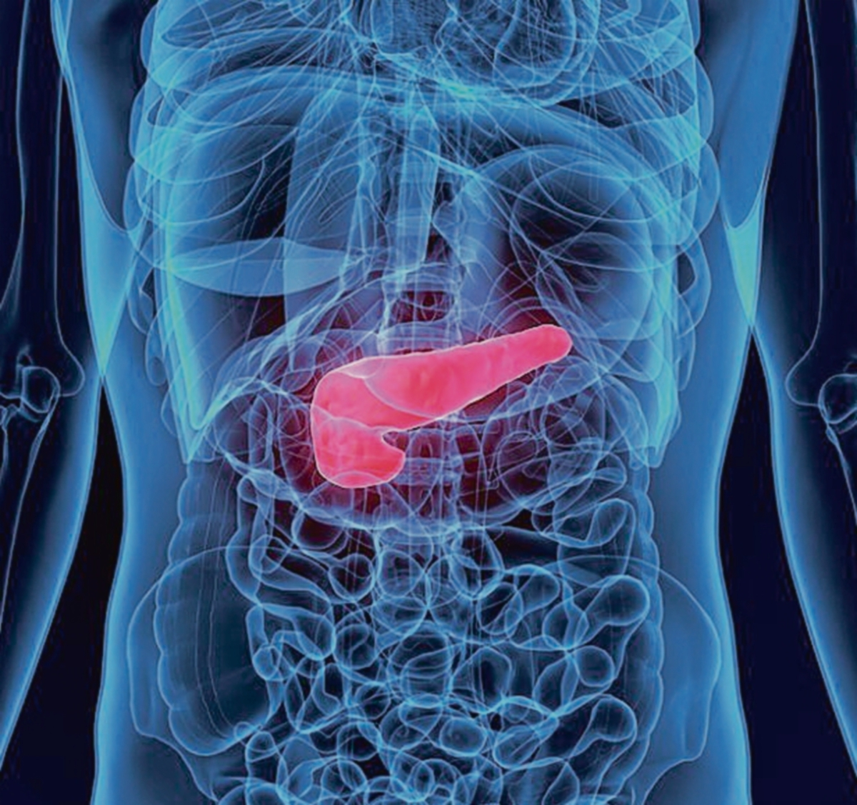 ¿Beber con moderación? También aumenta el riesgo de cáncer de páncreas