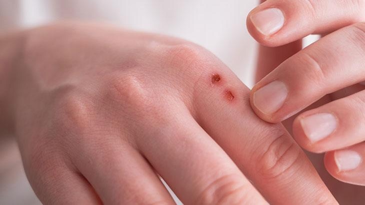 Parece simples, mas é sinal de problemas profundos! A abordagem correta é essencial para a cura.