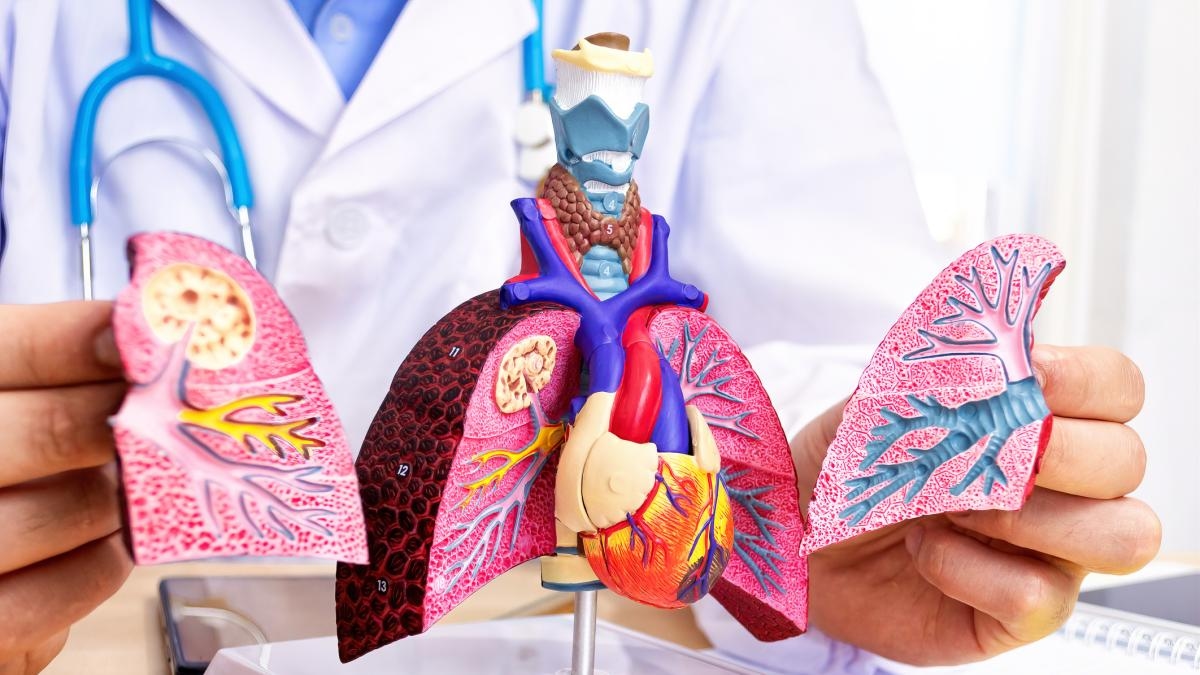 Reportan 111 casos de tuberculosis en la cárcel Modelo de Bucaramanga: ¿Cómo se está controlando?