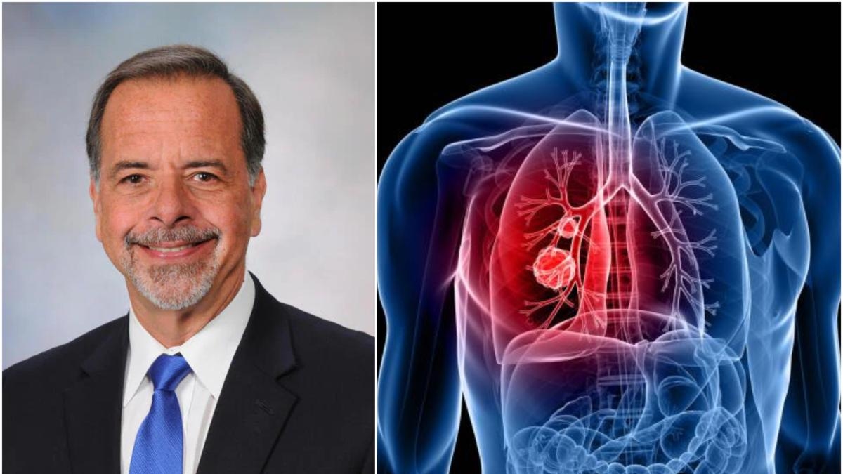 Lung cancer cases are increasing among people who have never smoked, and the reason is still unknown, warns a pulmonologist.