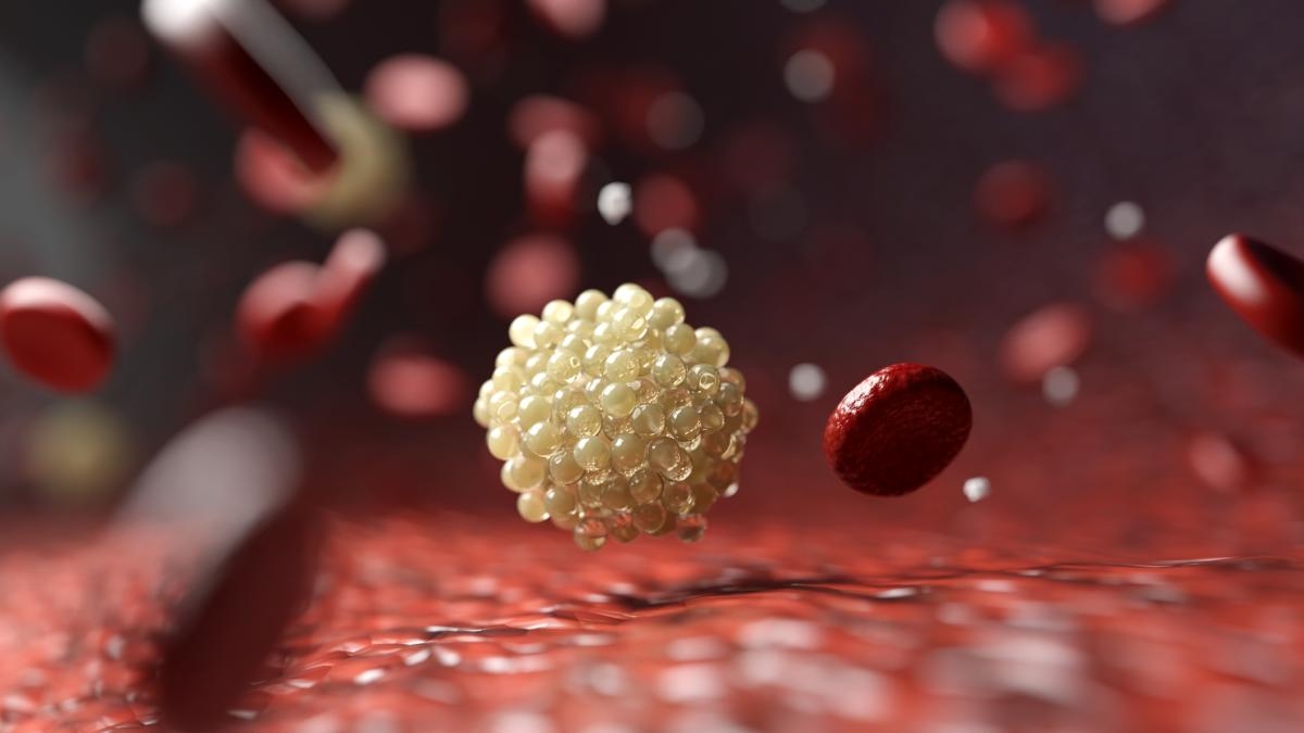 Naukowcom udało się obniżyć poziom „złego” cholesterolu o prawie połowę, stosując terapię skojarzoną z nowym lekiem.