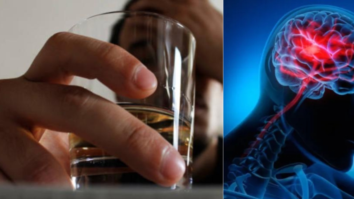 Excessive drinking can bring forward a stroke by more than 10 years and make recovery more difficult, according to a Harvard study.