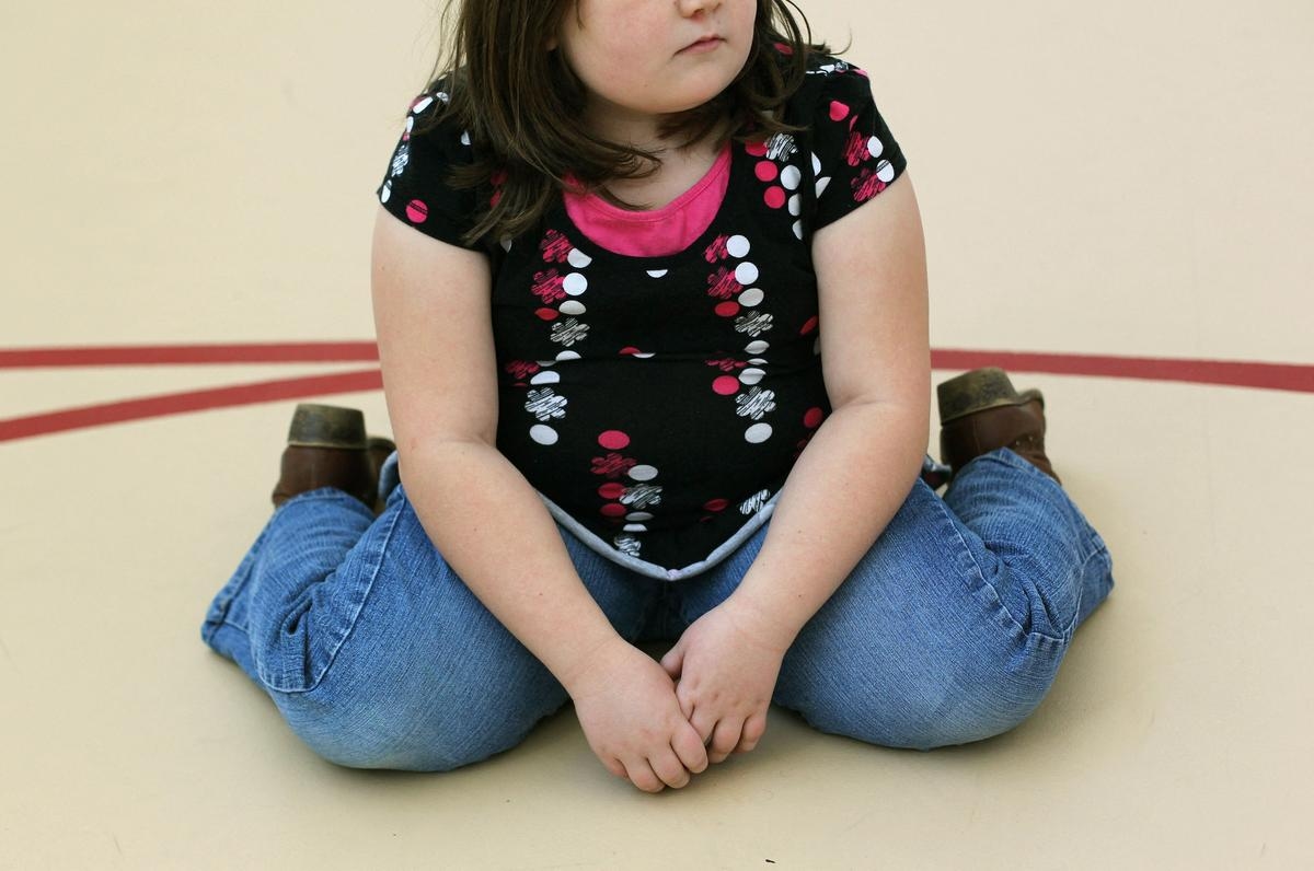 Childhood obesity now exceeds undernutrition in children and adolescents, warns UNICEF