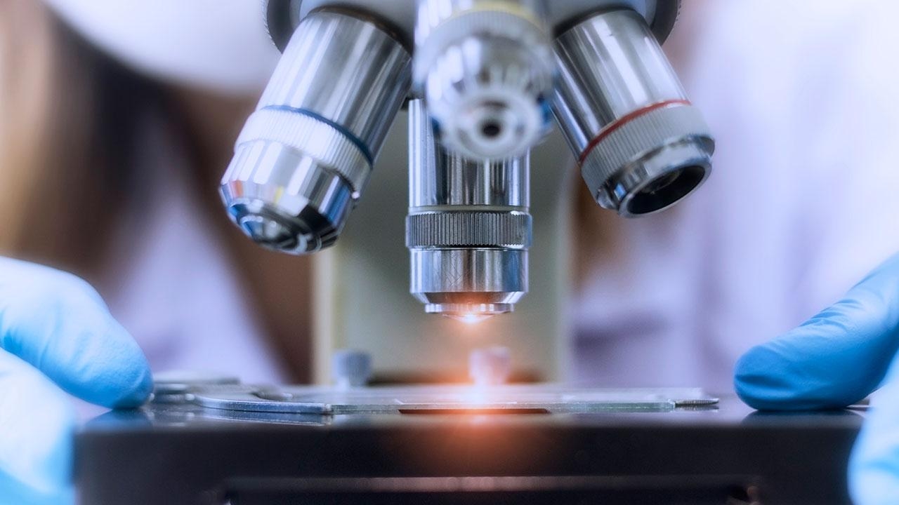 Türkische Wissenschaftler haben 12 Gene identifiziert, die die Reaktion auf Strahlentherapie bei Lungenkrebs bestimmen.