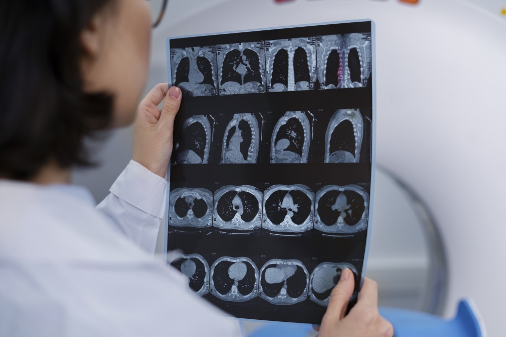Científicos crean una IA universal para analizar imágenes médicas