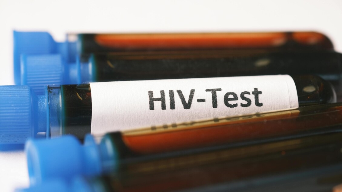Hiv in aumento tra i giovani, in un anno positivi da 1,6% a 2,4%