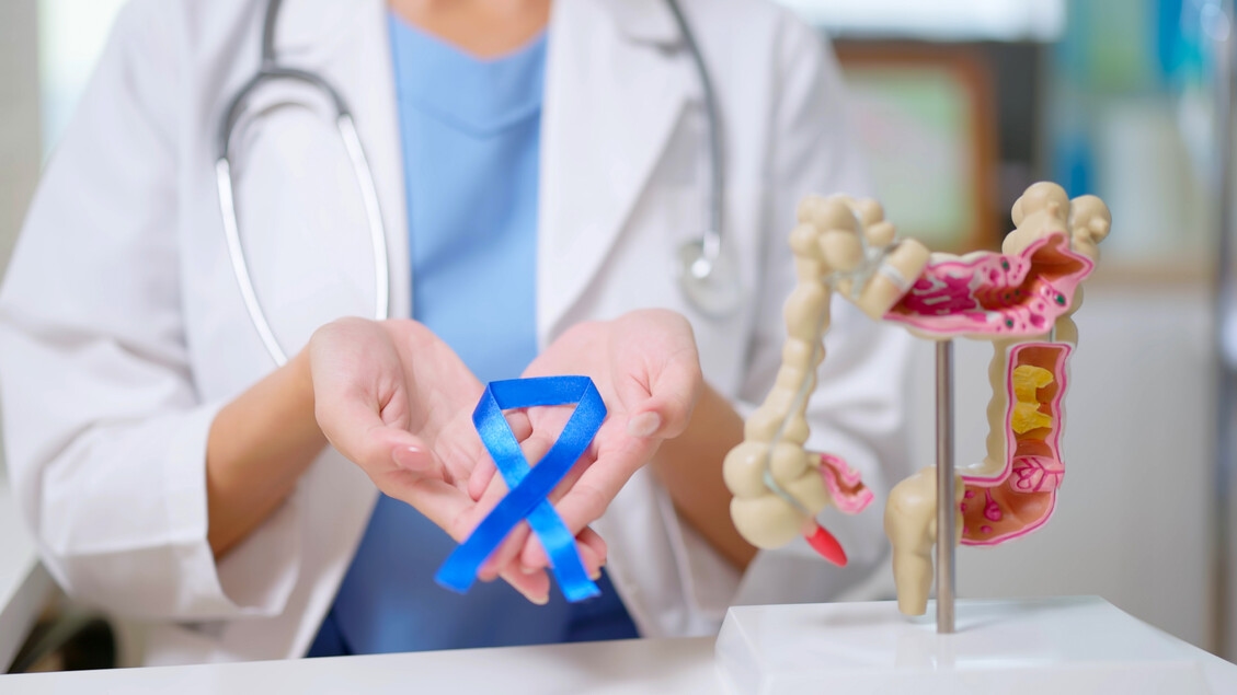 Nova estratégia torna os cânceres colorretais sensíveis à imunoterapia