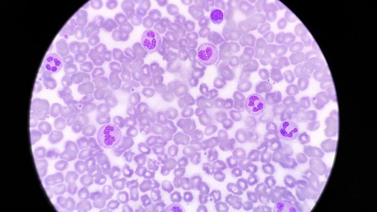 La luz del día puede aumentar la capacidad del sistema inmunológico para combatir infecciones