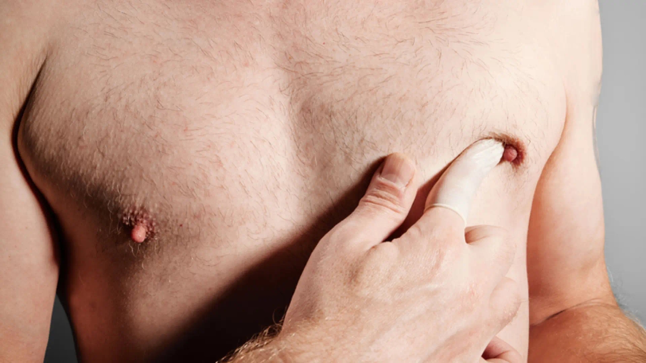 Homens com câncer de mama recomendam autoexame para evitar diagnóstico tardio