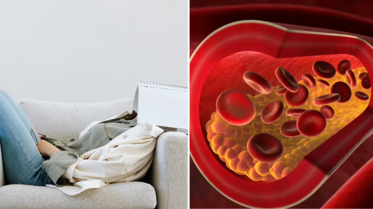 Weder Ernährung noch Bewegungsmangel: Dies ist ein weiterer Grund für einen hohen „schlechten“ Cholesterinspiegel.