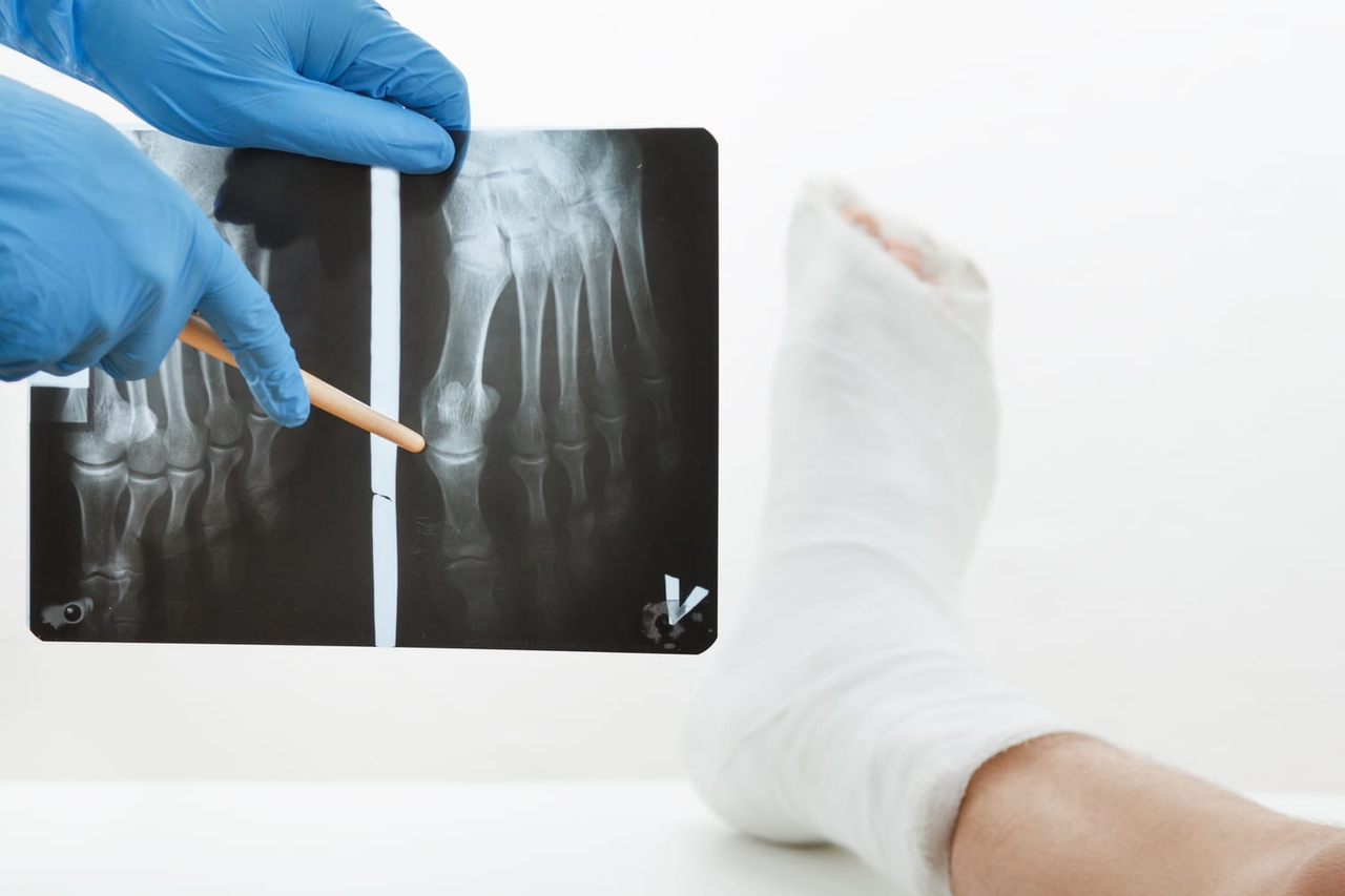 After age 50, you should avoid eating these foods: they are bad for your bones