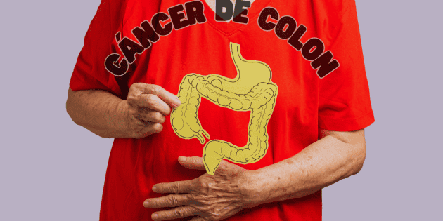 The dangerous advance of colon cancer in Mexico