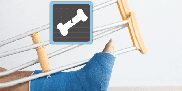 Fractures that could reveal osteoporosis