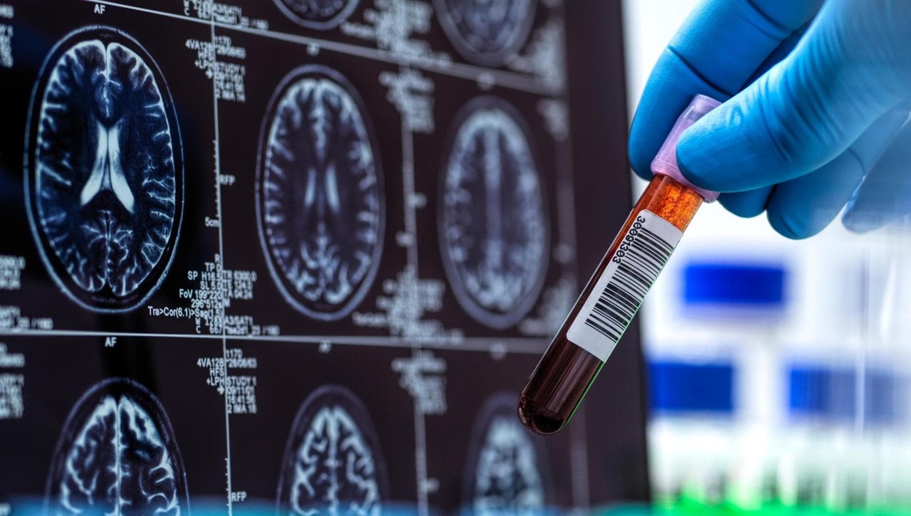 Память (и не только) под угрозой: мозг стареет из-за колебаний артериального давления