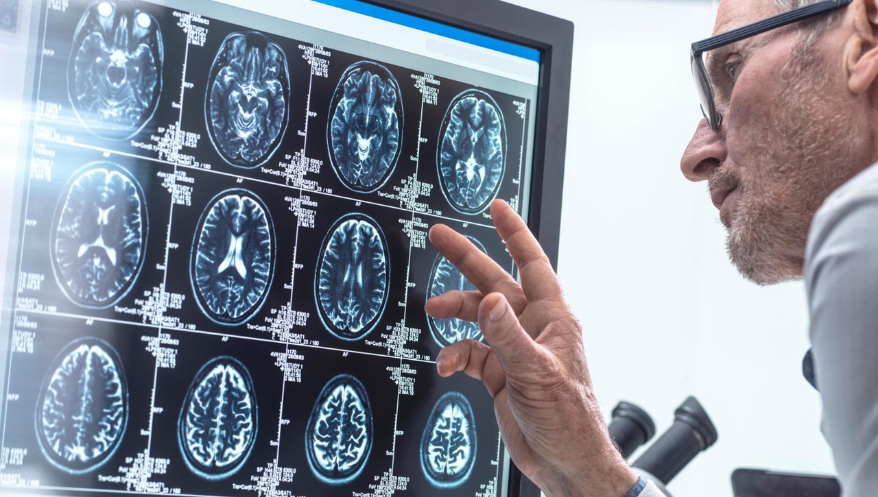 Рассеянный склероз: реестры заболеваний улучшают лечение